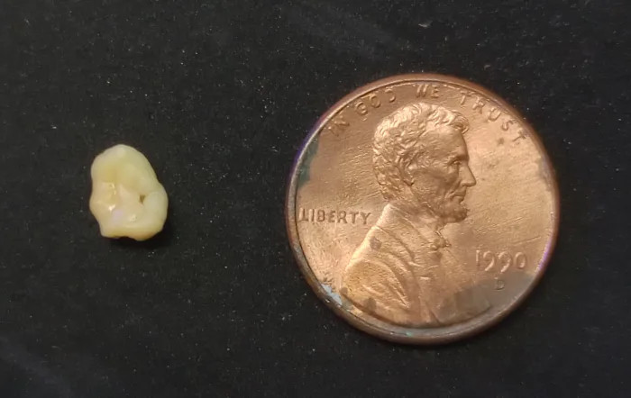 Person Stunned After Waking Up With This Rolling Around In Their Mouth - featured image Person Stunned After Waking Up With This Rolling Around In Their Mouth - featured image