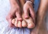 Expert explains why hairless toes can be a major indicator for dangerous condition Expert explains why hairless toes can be a major indicator for dangerous condition - featured image