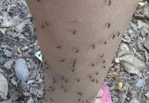 Why Mosquitoes Always Seem to Bite the Same People Why Mosquitoes Always Seem to Bite the Same People - featured image