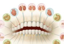 Each tooth is connected to an organ in the body: dental pain can be an indicator of future problems. Each tooth is connected to an organ in the body: dental pain can be an indicator of future problems. - featured image