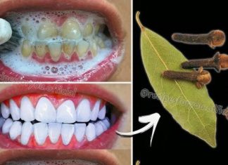 How Brightening Teeth with Bay Leaves Can Help Say Goodbye to Yellow Teeth – A Natural Remedy or Myth? How Brightening Teeth with Bay Leaves Can Help Say Goodbye to Yellow Teeth – A Natural Remedy or Myth? - featured image