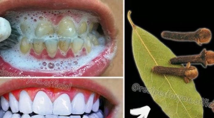 How Brightening Teeth with Bay Leaves Can Help Say Goodbye to Yellow Teeth – A Natural Remedy or Myth? How Brightening Teeth with Bay Leaves Can Help Say Goodbye to Yellow Teeth – A Natural Remedy or Myth? - featured image