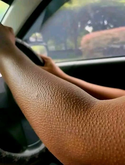 If Your Skin Looks Like This, Here’s What It Really Means - featured image If Your Skin Looks Like This, Here’s What It Really Means - featured image