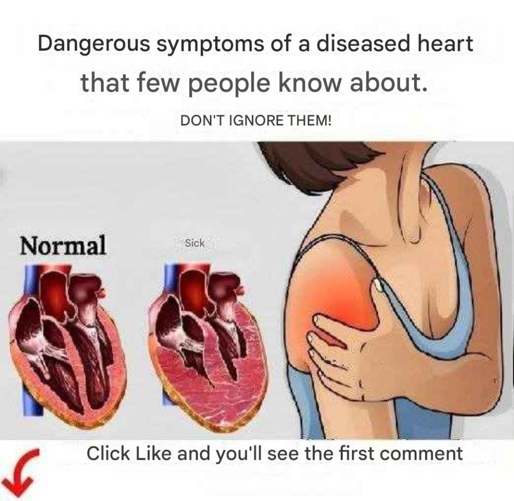 6 signs your body could give you weeks before a heart attack - featured image 6 signs your body could give you weeks before a heart attack - featured image