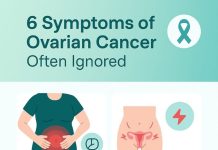 6 Often Overlooked Symptoms of Ovarian Cancer 6 Often Overlooked Symptoms of Ovarian Cancer - featured image