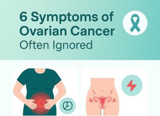 6 Often Overlooked Symptoms of Ovarian Cancer 6 Often Overlooked Symptoms of Ovarian Cancer - featured image