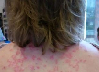 Here are the consequences of sleeping with… Here are the consequences of sleeping with… - featured image