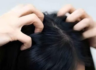 Itchy head? Here are the main causes Itchy head? Here are the main causes - featured image