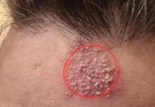 💄 The Real Consequences of Sleeping in Your Makeup – Why You Should Never Skip This Step 🧴👁️ 💄 The Real Consequences of Sleeping in Your Makeup – Why You Should Never Skip This Step 🧴👁️ - featured image