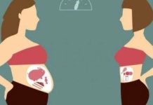 Baking soda removes grease from all these areas—the only way to do it is to prepare it this way! Baking soda removes grease from all these areas—the only way to do it is to prepare it this way! - featured image