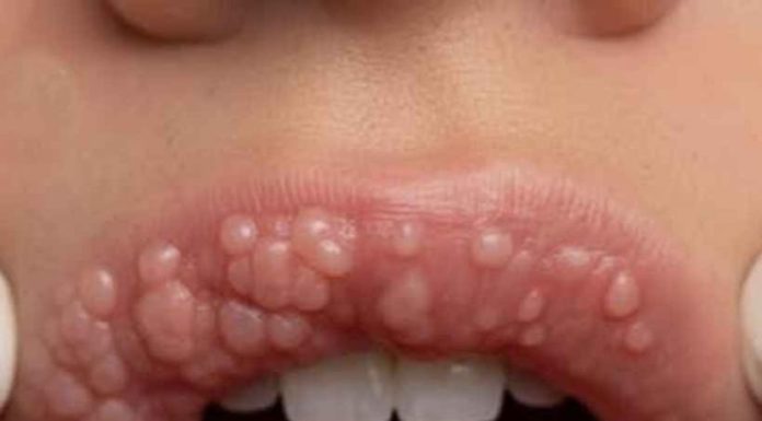 This isn’t meant to scare people. It’s meant to inform, prevent, and talk about what almost no one wants to talk about… This isn’t meant to scare people. It’s meant to inform, prevent, and talk about what almost no one wants to talk about… - featured image