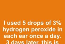 I used 5 drops of 3% hydrogen peroxide in each ear once a day. 3 days later, this is what happened I used 5 drops of 3% hydrogen peroxide in each ear once a day. 3 days later, this is what happened - featured image
