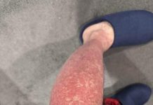 These are the consequences of sleeping with…See more These are the consequences of sleeping with…See more - featured image