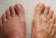 One Month Before a Heart Attack, Your Body Will Alert You: Here Are the 6 Symptoms! One Month Before a Heart Attack, Your Body Will Alert You: Here Are the 6 Symptoms! - featured image