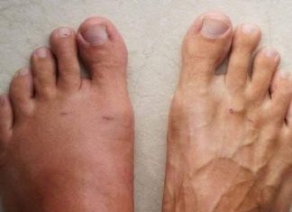 One Month Before a Heart Attack, Your Body Will Alert You: Here Are the 6 Symptoms! One Month Before a Heart Attack, Your Body Will Alert You: Here Are the 6 Symptoms! - featured image