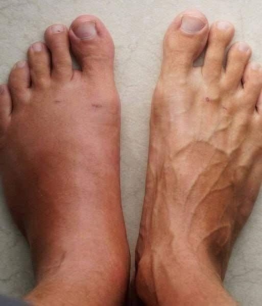 One Month Before a Heart Attack, Your Body Will Alert You: Here Are the 6 Symptoms! - featured image One Month Before a Heart Attack, Your Body Will Alert You: Here Are the 6 Symptoms! - featured image