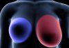 Breast cancer: 4 early signs every woman should know. Breast cancer: 4 early signs every woman should know. - featured image