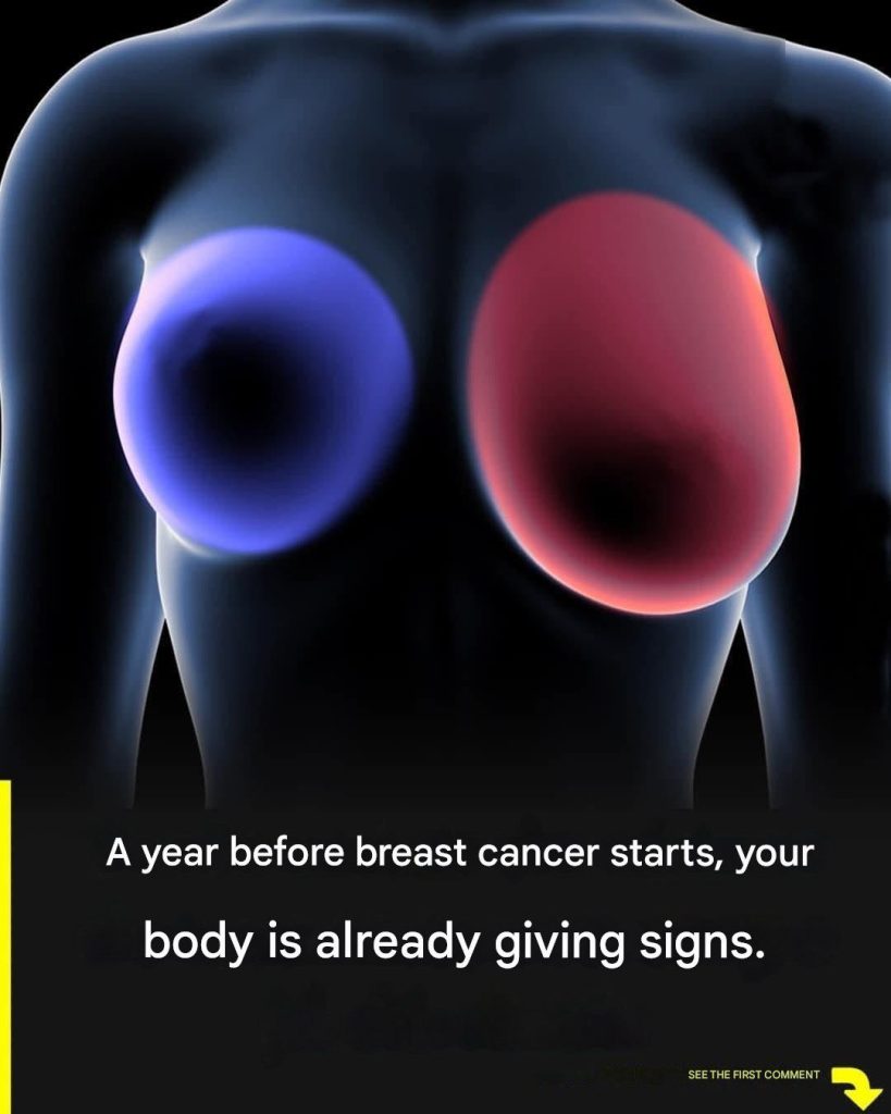 Breast cancer: 4 early signs every woman should know. - featured image Breast cancer: 4 early signs every woman should know. - featured image