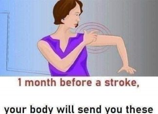 Stroke: These indicators that manifest one month prior to.. Stroke: These indicators that manifest one month prior to.. - featured image