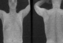 Old Airport X-Ray Secrets Old Airport X-Ray Secrets - featured image