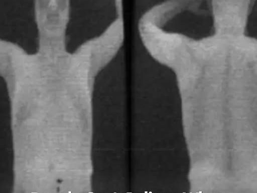 Old Airport X-Ray Secrets Old Airport X-Ray Secrets - featured image