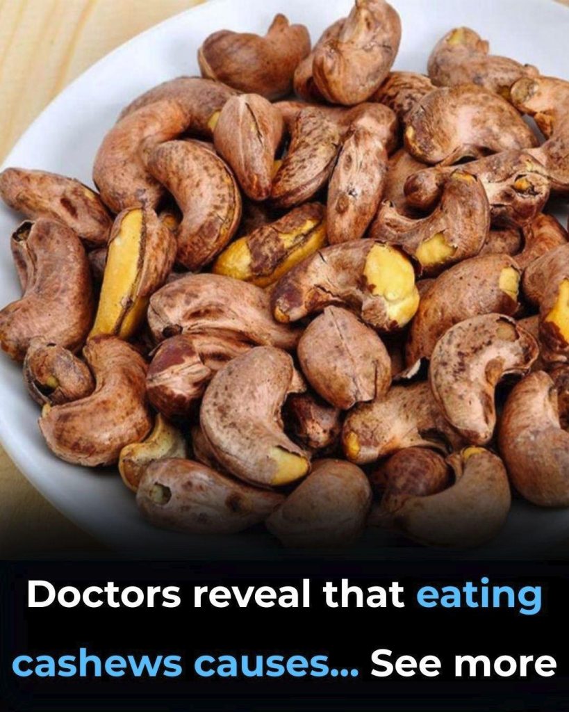 Doctors reveal that eating cashews causes - featured image Doctors reveal that eating cashews causes - featured image