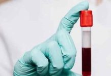 Can your blood group determine how quickly you send it? Where the studies reveal you will be surprised Can your blood group determine how quickly you send it? Where the studies reveal you will be surprised - featured image
