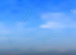 What are floaters? Here’s what you should do if you see them. What are floaters? Here’s what you should do if you see them. - featured image