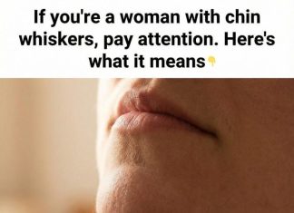 Women’s Chin Hair: Causes and Confident Ways to Handle It Women’s Chin Hair: Causes and Confident Ways to Handle It - featured image
