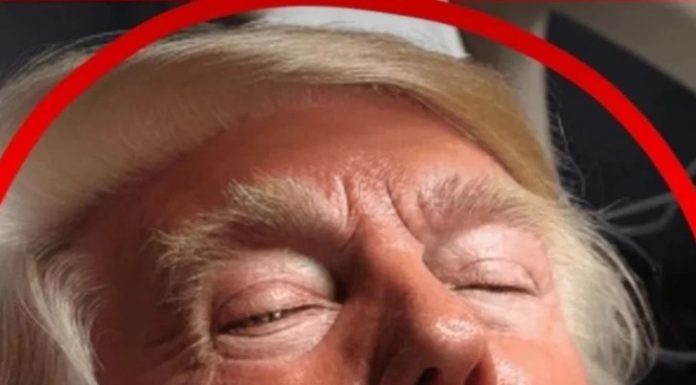 During a campaign event in Pennsylvania, Donald Trump sustained an injury to his ear. His campaign later stated that he is in stable condition and doing well. During a campaign event in Pennsylvania, Donald Trump sustained an injury to his ear. His campaign later stated that he is in stable condition and doing well. - featured image