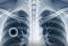 This over-the-counter product has plunged a young father into a coma: the surprising revelations This over-the-counter product has plunged a young father into a coma: the surprising revelations - featured image