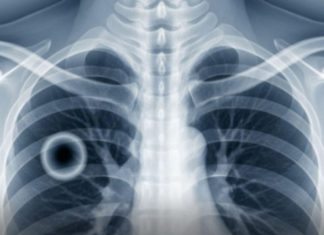 This over-the-counter product has plunged a young father into a coma: the surprising revelations This over-the-counter product has plunged a young father into a coma: the surprising revelations - featured image