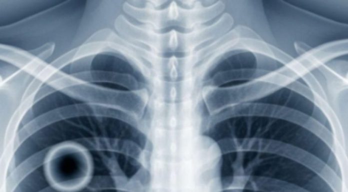 This over-the-counter product has plunged a young father into a coma: the surprising revelations This over-the-counter product has plunged a young father into a coma: the surprising revelations - featured image