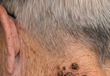 Warning Signs on Skin Warning Signs on Skin - featured image