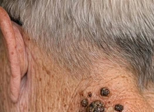 Warning Signs on Skin Warning Signs on Skin - featured image