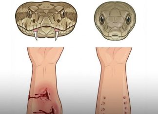 Bitten by a Snake? Here’s the First Thing You Must Do — It Could Save Your Life Bitten by a Snake? Here’s the First Thing You Must Do — It Could Save Your Life - featured image