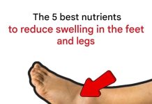 The 5 best nutrients to reduce swelling in the feet and legs The 5 best nutrients to reduce swelling in the feet and legs - featured image