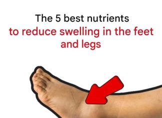 The 5 best nutrients to reduce swelling in the feet and legs The 5 best nutrients to reduce swelling in the feet and legs - featured image