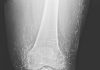 Doctors Stunned After Looking At This X-Ray Of Woman Suffering Joint Pain Doctors Stunned After Looking At This X-Ray Of Woman Suffering Joint Pain - featured image