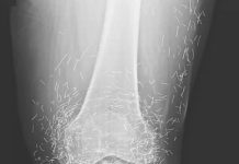 Doctors Stunned After Looking At This X-Ray Of Woman Suffering Joint Pain Doctors Stunned After Looking At This X-Ray Of Woman Suffering Joint Pain - featured image