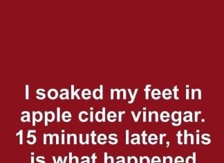 What Apple Cider Vinegar Might Do for Your Scalp and Skin What Apple Cider Vinegar Might Do for Your Scalp and Skin - featured image