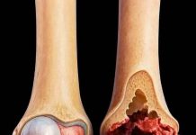 ATTENTION These are the consequences of sleeping with… ATTENTION These are the consequences of sleeping with… - featured image