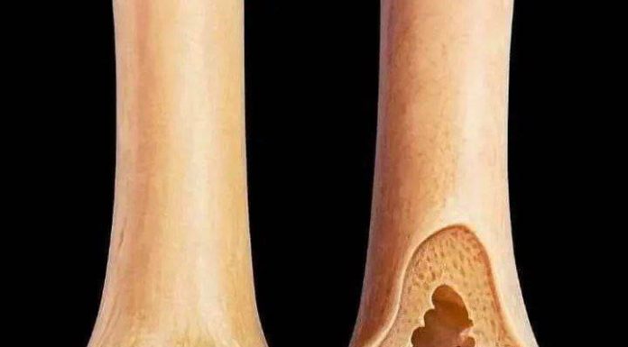 ATTENTION These are the consequences of sleeping with… ATTENTION These are the consequences of sleeping with… - featured image