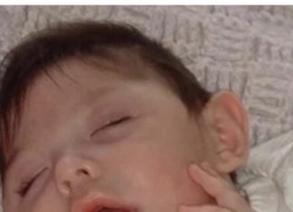 An Inspiring Story: Doctors Once Doubted Her Survival, But She Is Now Thriving at 20 An Inspiring Story: Doctors Once Doubted Her Survival, But She Is Now Thriving at 20 - featured image