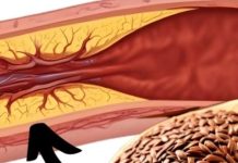 1 Tablespoon a Day: Flaxseed to Prevent Blood Clots, Heart Attacks, and Strokes! 1 Tablespoon a Day: Flaxseed to Prevent Blood Clots, Heart Attacks, and Strokes! - featured image