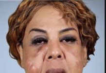 What “Cement Face” lady looks like 21 years later What “Cement Face” lady looks like 21 years later - featured image