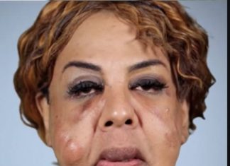 What “Cement Face” lady looks like 21 years later What “Cement Face” lady looks like 21 years later - featured image