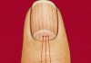 What Vertical Lines on Your Nails Can Reveal About Aging What Vertical Lines on Your Nails Can Reveal About Aging - featured image