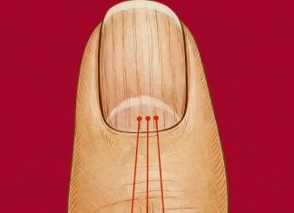 What Vertical Lines on Your Nails Can Reveal About Aging What Vertical Lines on Your Nails Can Reveal About Aging - featured image