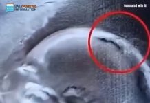 “Unusual Finding Appears on Ultrasound, Capturing Doctors’ Attention” “Unusual Finding Appears on Ultrasound, Capturing Doctors’ Attention” - featured image